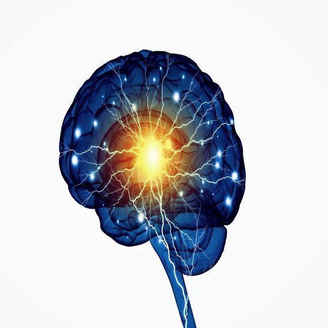 Onderzoek naar ‘atlas van hersenschade’ na radiotherapie krijgt subsidie